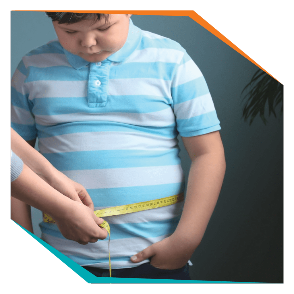20220511 Shw Image Childhood Obesity